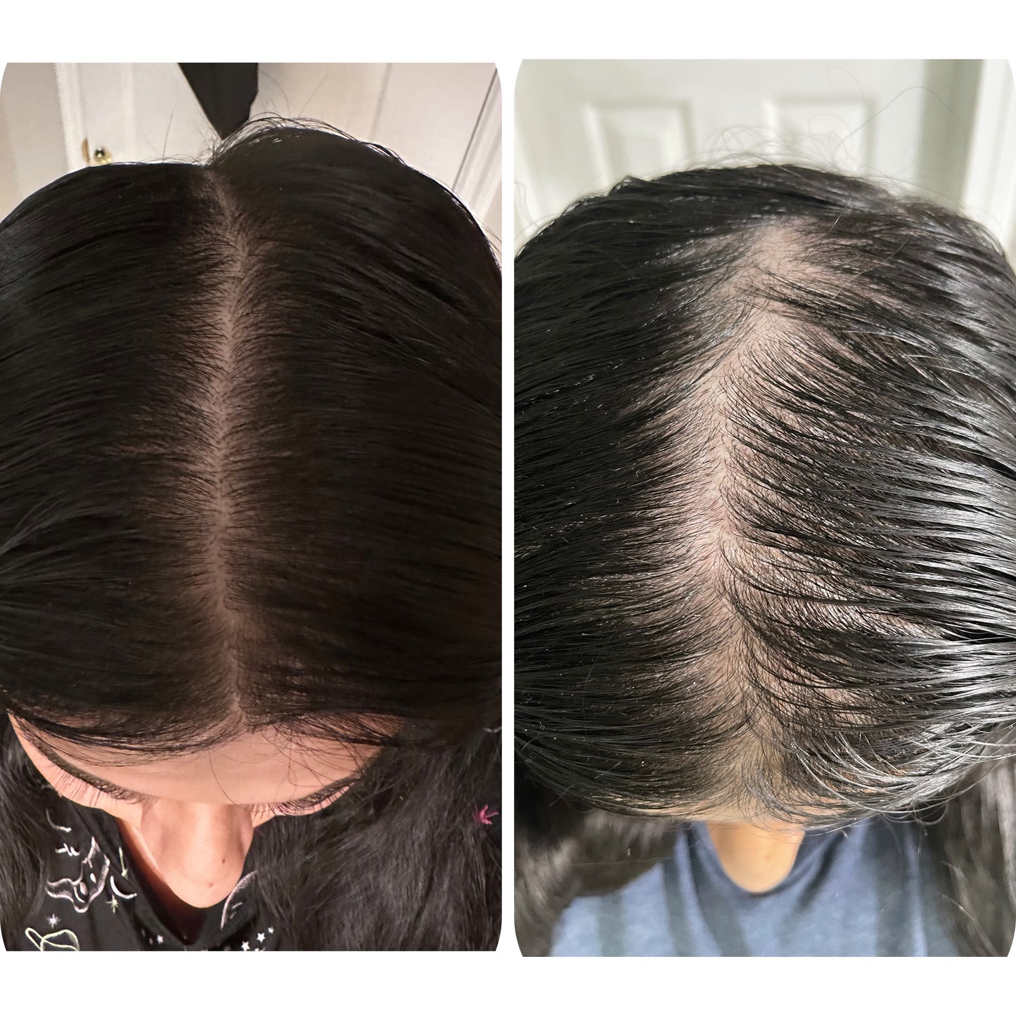 Her Roots Hair Growth  Oil