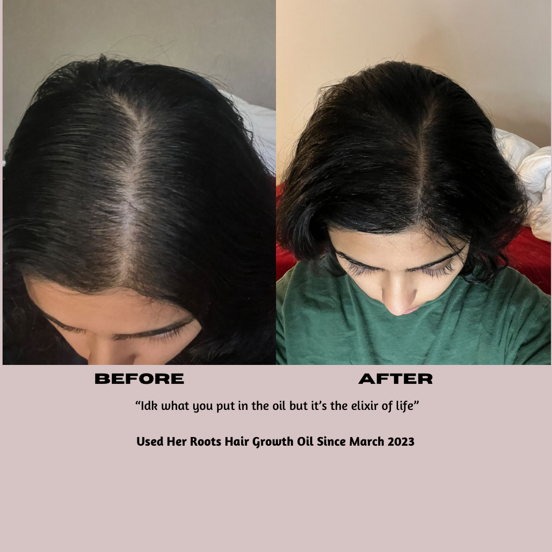 Her Roots Hair Growth  Oil
