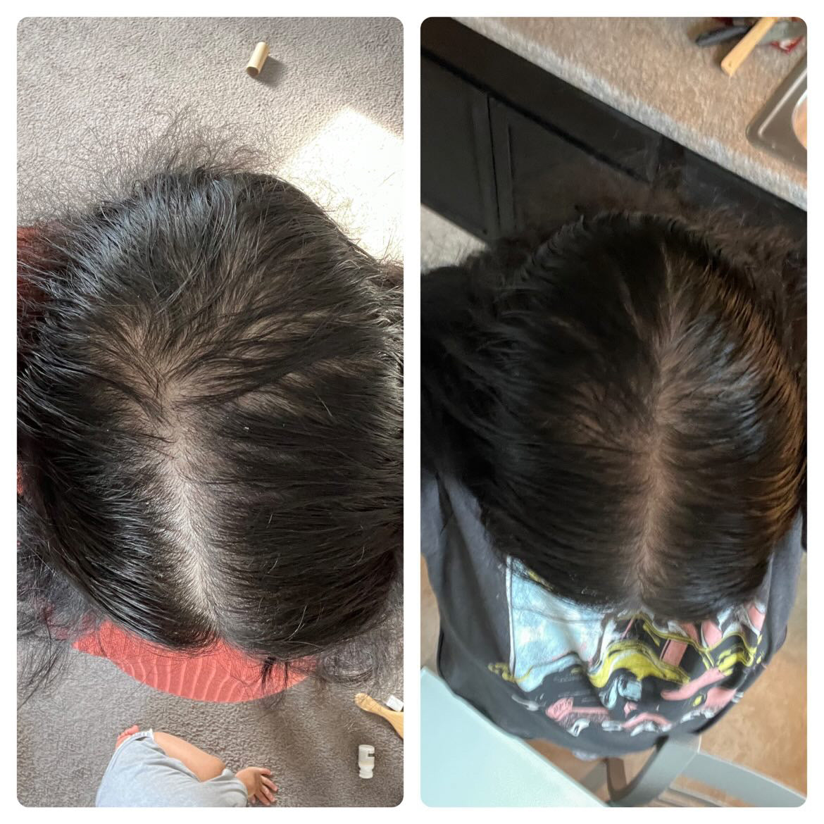 Her Roots Hair Growth  Oil