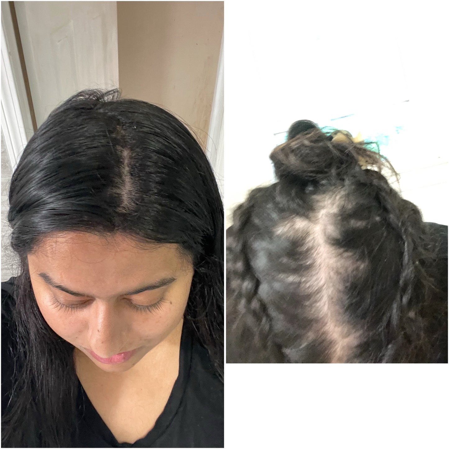 Her Roots Hair Growth  Oil