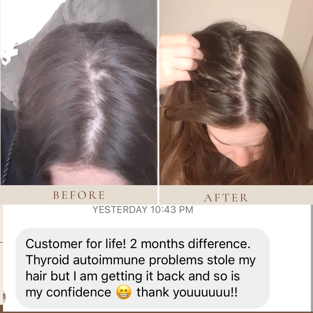 Her Roots Hair Growth  Oil