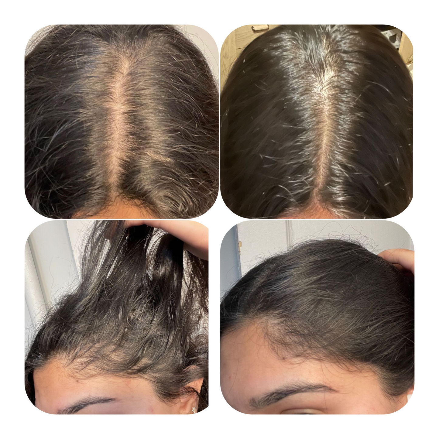 Her Roots Hair Growth  Oil